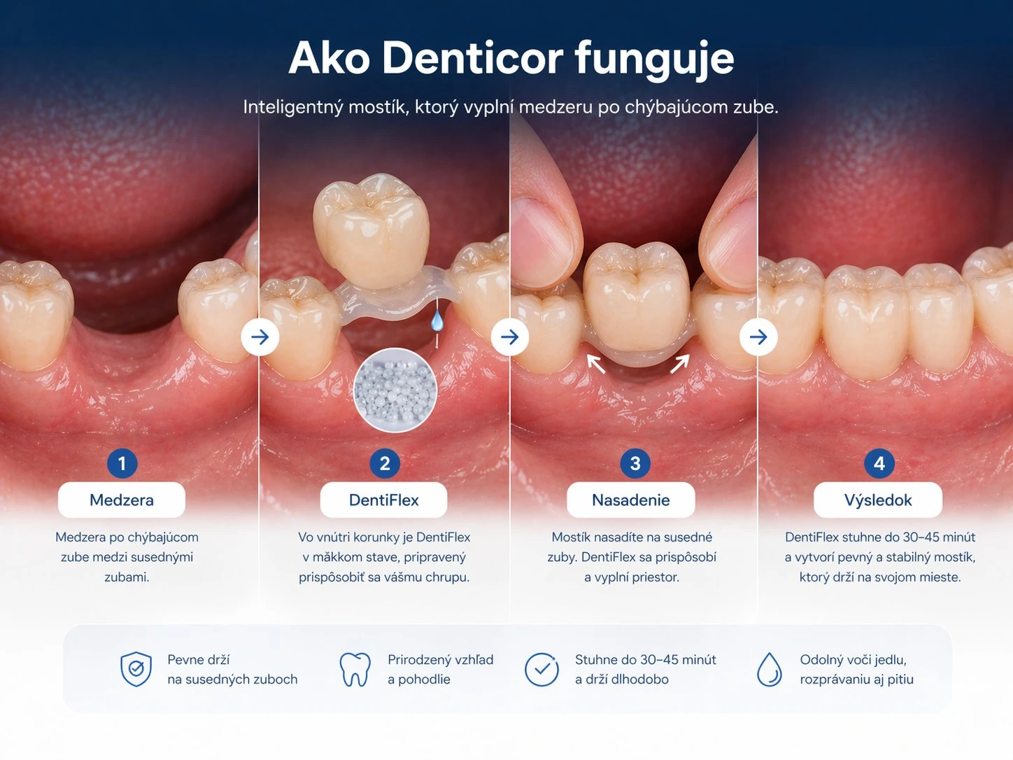 Bildverlauf Denticor – Schritt 7: provisorische Versorgung – drei obere Frontzähne