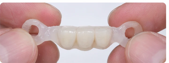 Bildverlauf Denticor — Schritt 2: provisorische Versorgung — unterer mittlerer, seitlicher Schneidezahn und Eckzahn
