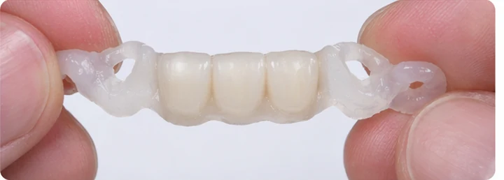 Bildverlauf Denticor — Schritt 4: provisorische Versorgung — unterer mittlerer, seitlicher Schneidezahn und Eckzahn