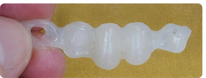 Bildverlauf Denticor – Schritt 2: provisorische Versorgung – zwei obere Prämolaren und ein Backenzahn