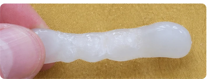 Bildverlauf Denticor – Schritt 2: provisorische Versorgung – oberer Eckzahn und zwei Prämolaren