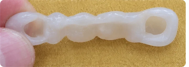 Bildverlauf Denticor – Schritt 4: provisorische Versorgung – oberer Eckzahn und zwei Prämolaren